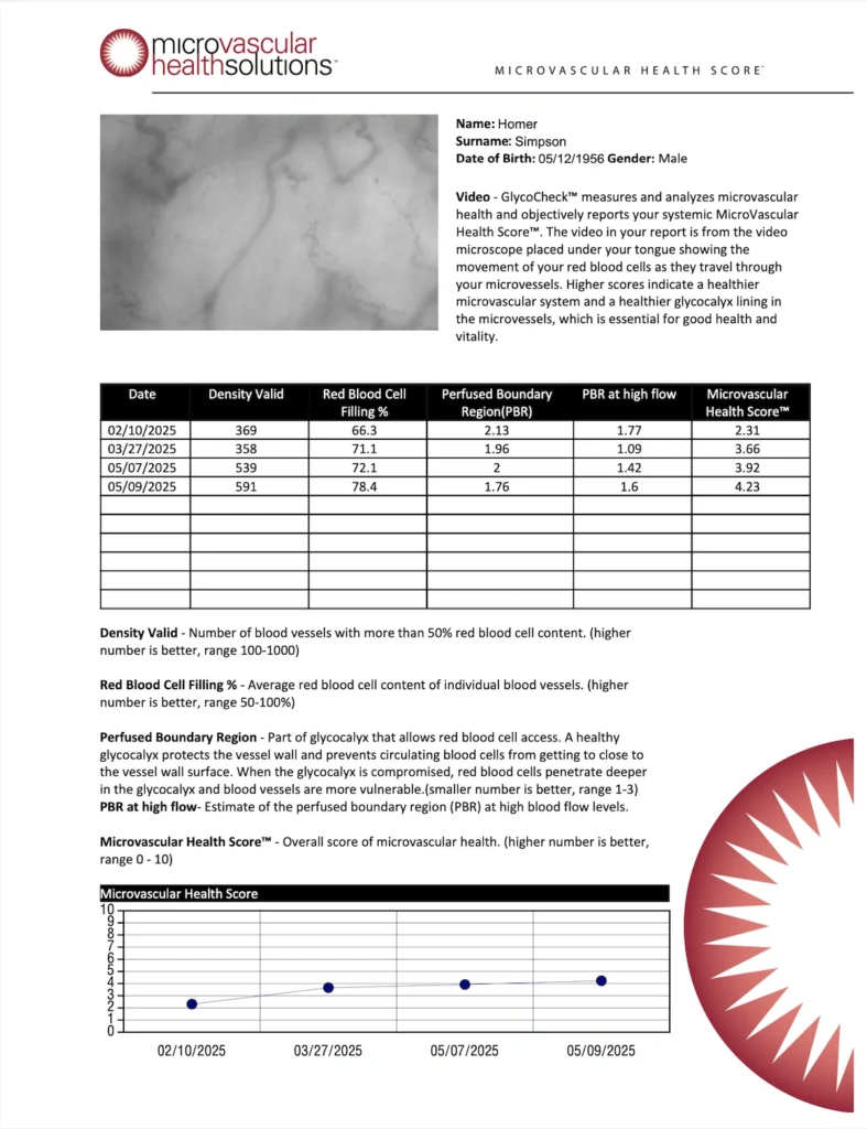 Microvascular Health Score (MVHS) report resulting from capillary health assessment using GlycoCheck technology by Microvascular Health Solutions