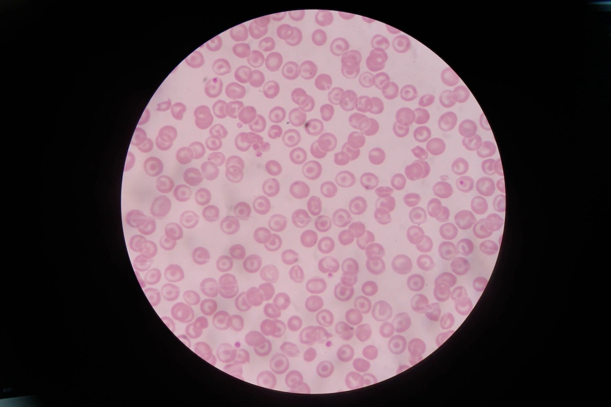 Red blood cells under the microscope