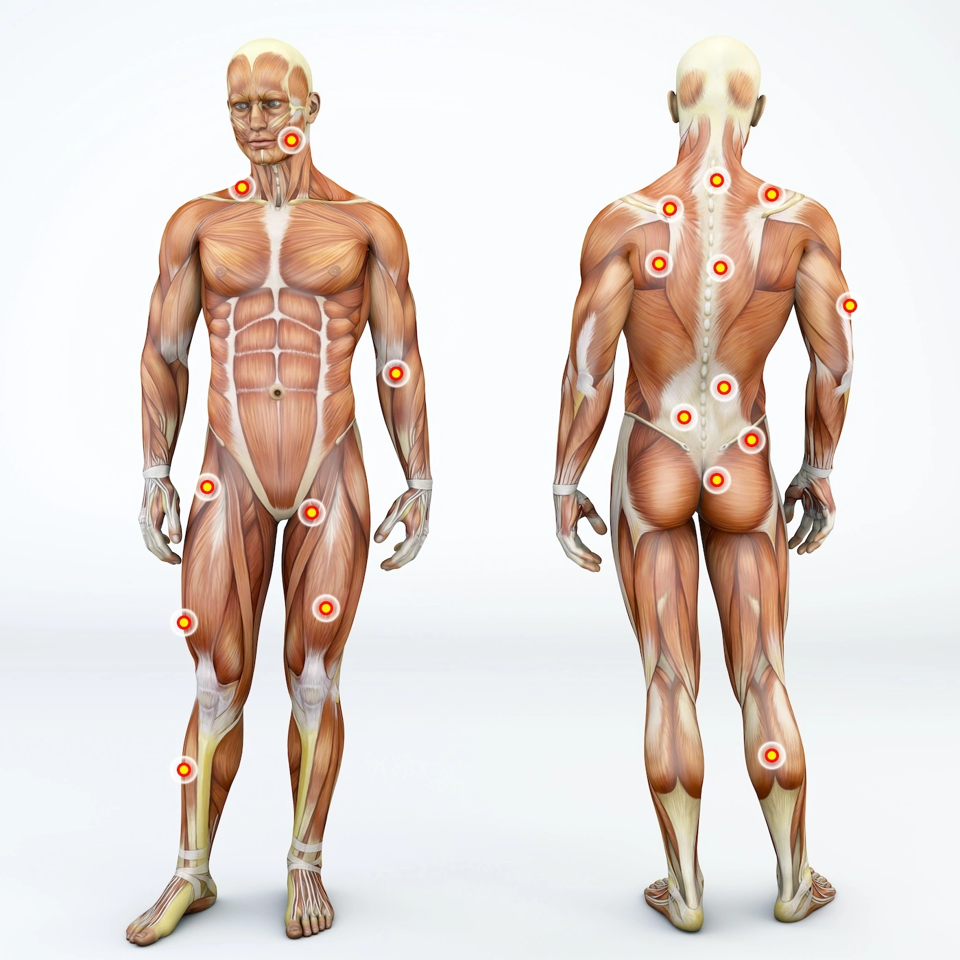 Common muscle trigger point locations schematic representation