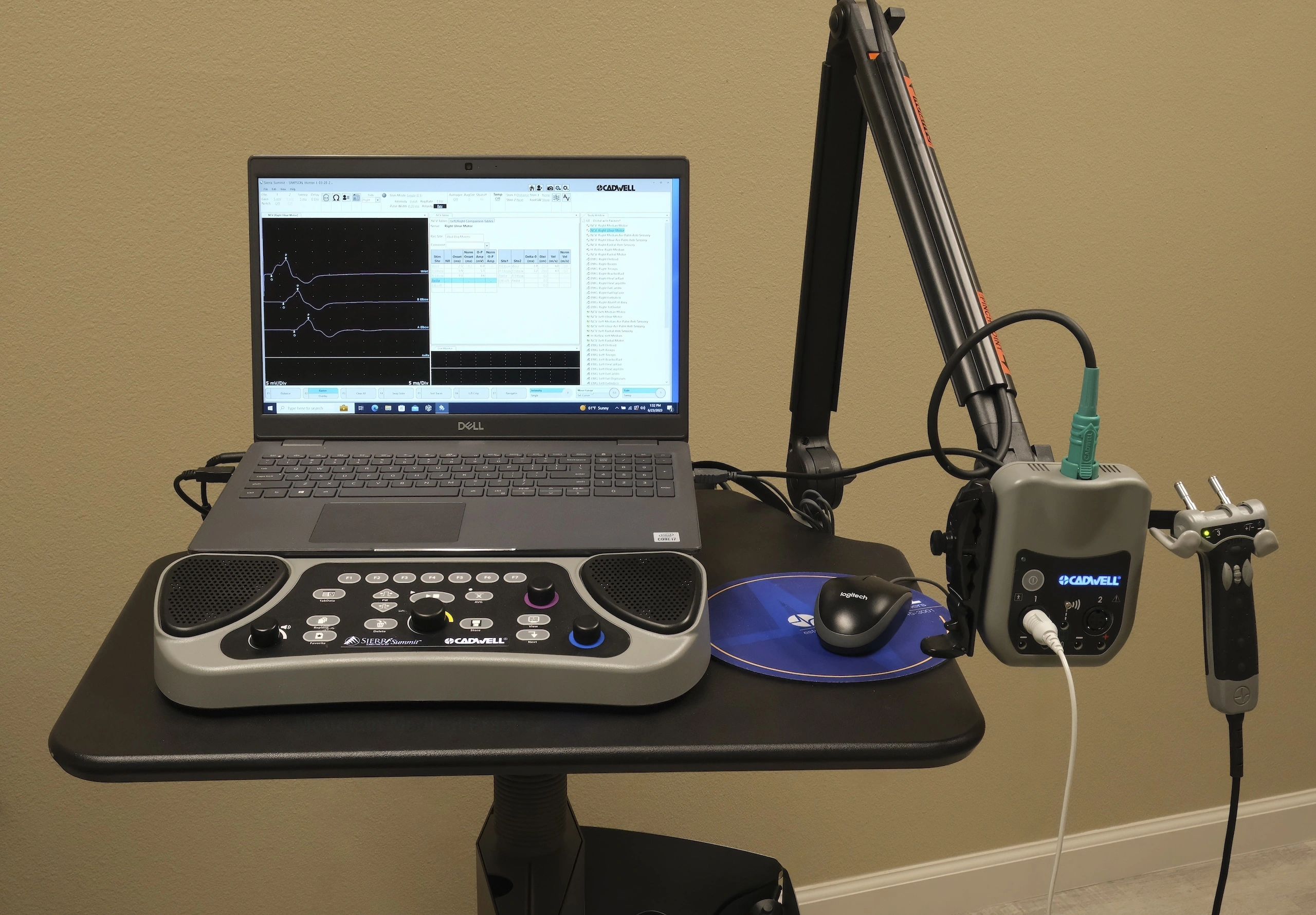 Cadwell Sierra Summit EMG machine with screen monitor displaying ulnar motor nerve conduction waveforms