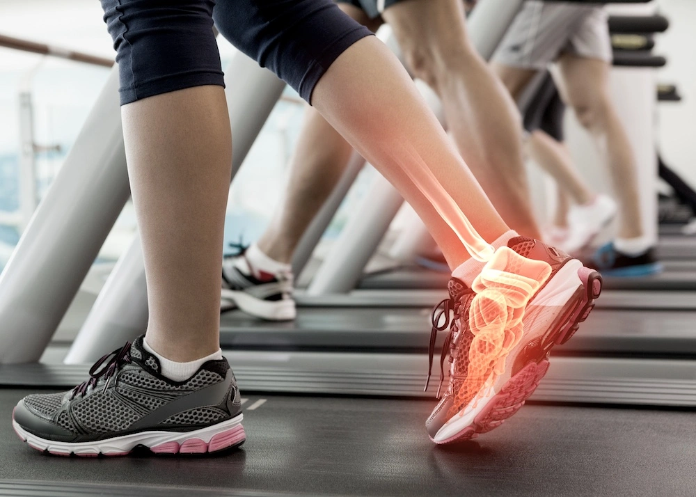 Female walking on treadmill with inset hologram of painful ankle joint and foot bones