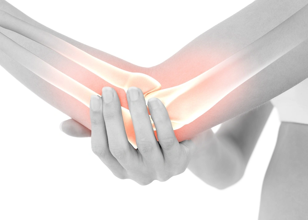 Female clutching elbow in pain with inset hologram of elbow joint bones